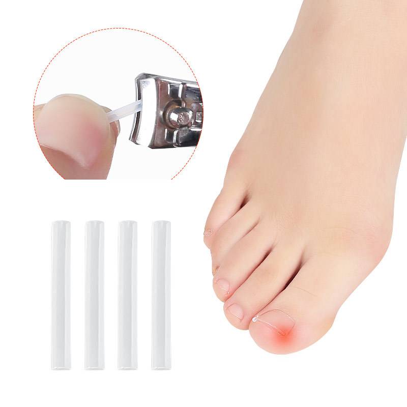 Filler Nail Pad Plaster Nail Silk Brace